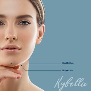 KYBELLA INJECTIONS 10mg/mL